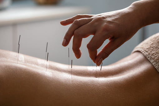 acupuncture san diego class